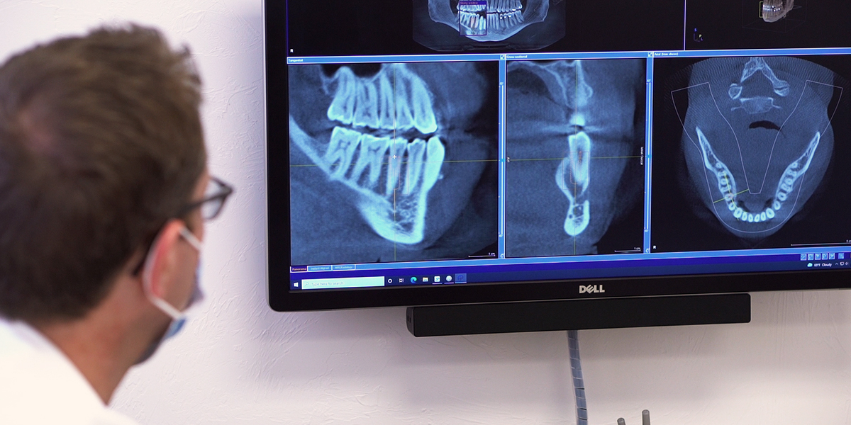 Cone beam scanner