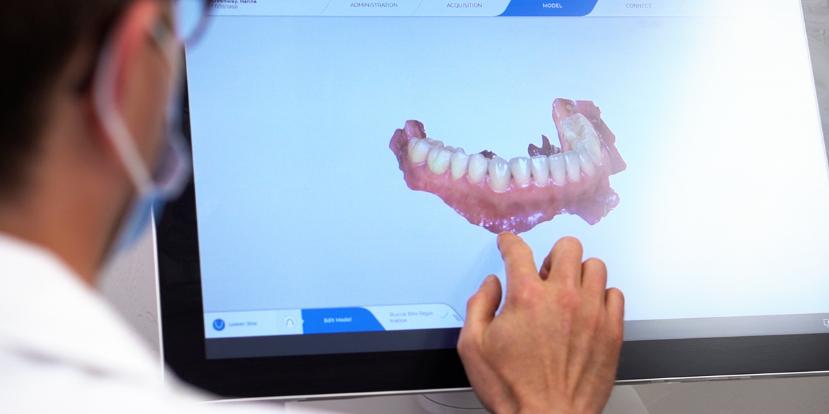 digital intraoral scans